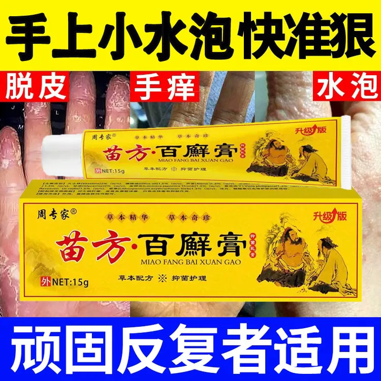 手起小水泡止痒膏脱皮抑菌克星手指间痒干裂专用软膏