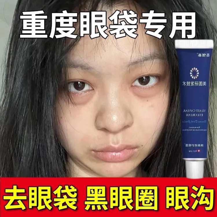 【去掉大眼袋】快速去眼袋去黑眼圈去细纹紧致抗皱男女眼袋眼霜膏