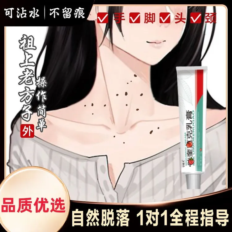 去脖子手上腋下身上长肉粒乳膏无痛便携不留坑外用涂抹正品草本