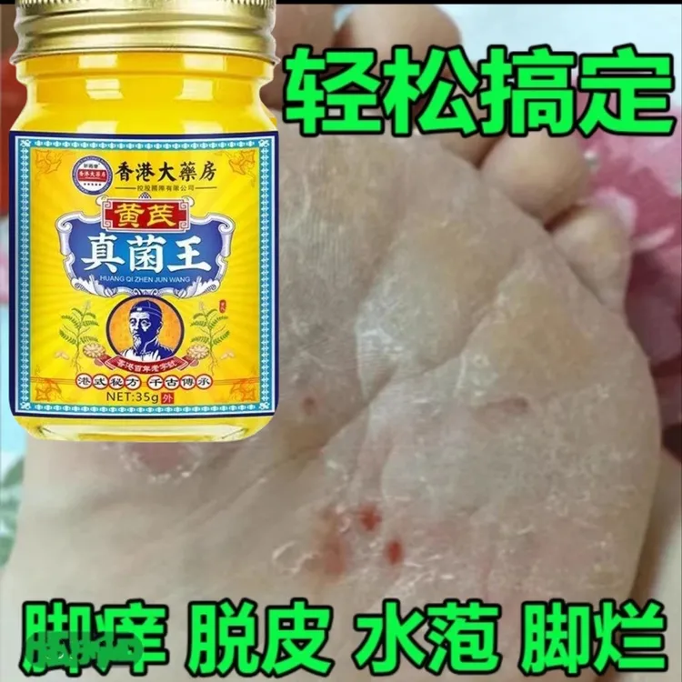 正品新款香港真菌王原装脚部护理全身可用植物草本萃取抑菌乳膏