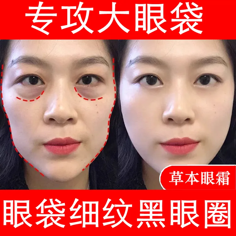 改善细纹黑眼圈男女士眼部精华油草本眼霜保湿补水去眼袋消除神器