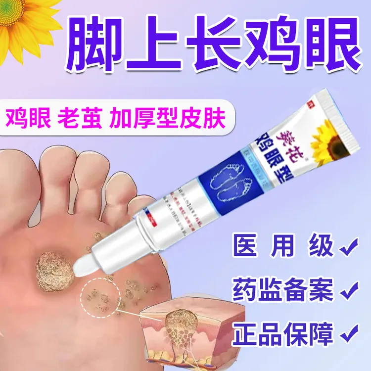 葵花 官方正品 鸡眼型医用退热凝胶 男女通用款去手上脚趾脚后跟鸡眼贴脚眼贴 肉茧 疣瘊护理 鸡眼专用凝胶