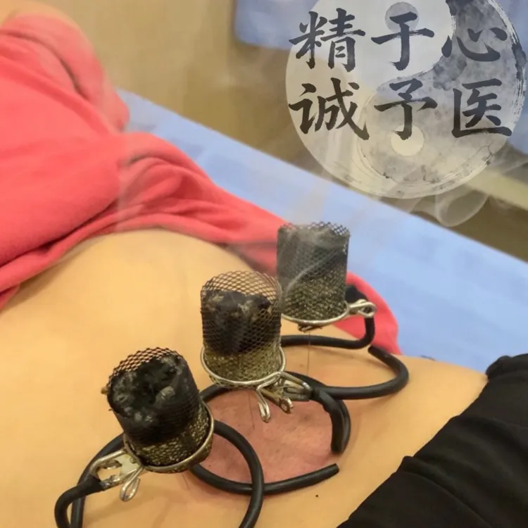 温针灸防落灰器（适用 18-25mm 艾柱或艾绒）一个固定器和防落灰网