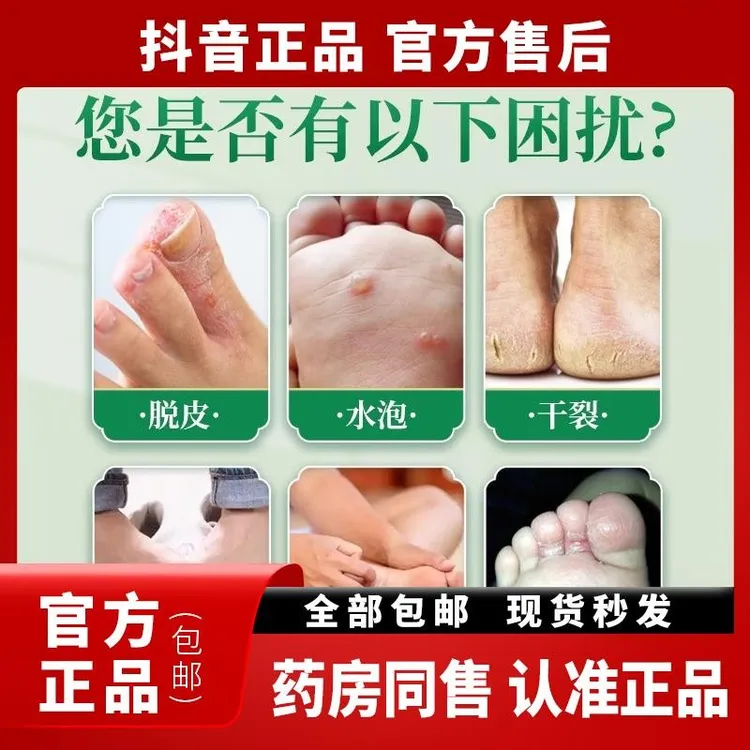 【买2送1】祥抑菌膏联苯脚爽喷雾剂联苯止痒抑菌液抗真菌喷雾剂