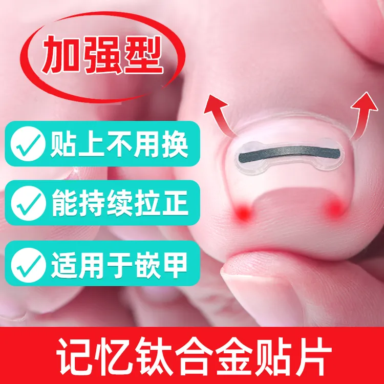 JIAOYISHENG/脚医生脚趾甲贴片嵌甲甲沟炎矫正指甲扎肉专用正甲贴足部固定器 