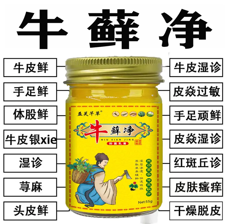 【牛藓净】全身牛皮廯/银屑藓皮肤止痒天然温和植物草本抑菌止痒膏