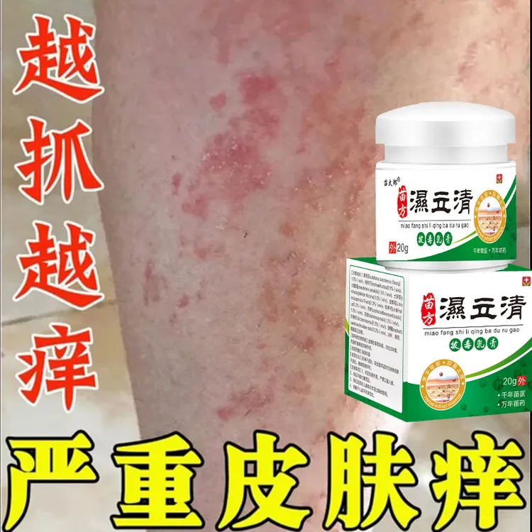 湿立清皮肤瘙痒寻麻痒顽固湿痒皮肤红班止痒膏抑菌身体护理