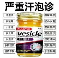 汗泡诊手上起小水泡止痒膏脱皮抑菌手指缝痒干裂草本萃取涂抹乳膏