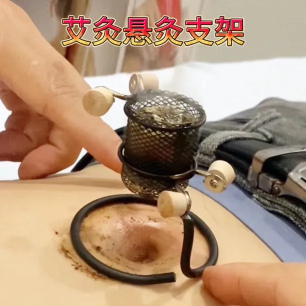 艾灸悬灸支架艾灸工具穴位艾灸隔物灸