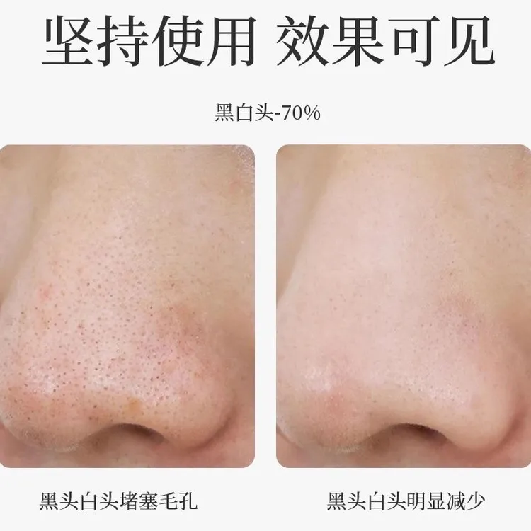 SCHHUBBI施华碧碳酸活肤清洁小罐膜SCZ04