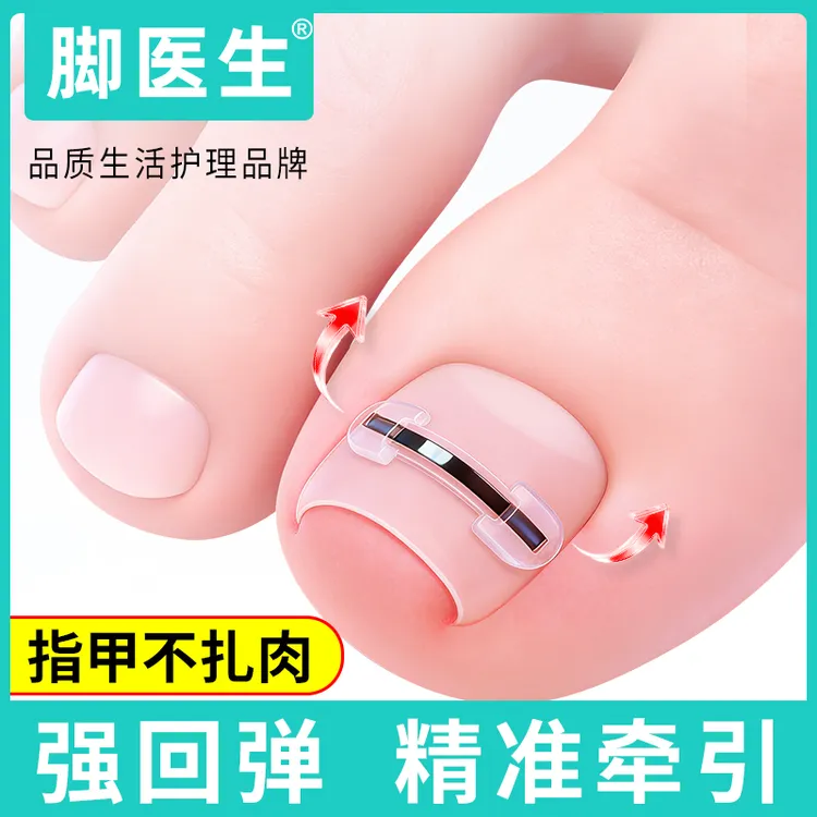 JIAOYISHENG/脚医生脚趾甲贴片嵌甲矫正指甲专用正甲贴足部固定器商品图