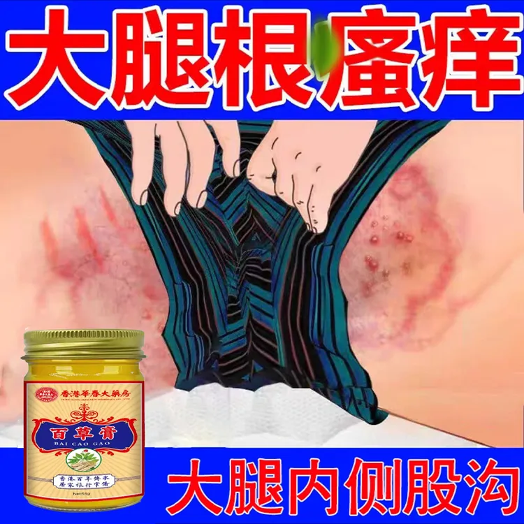 大腿内侧瘙痒男女发红发黑越抓越痒大腿缝处潮湿异味快速止痒膏