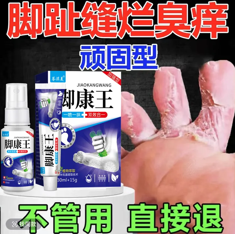 脚趾缝烂臭痒专用止痒膏顽固足部抑菌止痒草本喷雾剂特效温和搭配