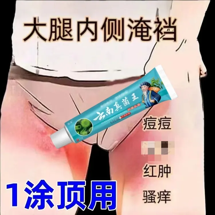 大腿内侧瘙痒越抓越痒大腿和睾丸夹缝处潮湿异味外用止痒抑菌乳膏