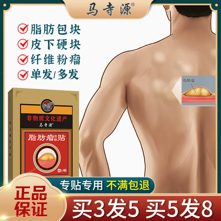 马寺源脂肪瘤贴皮下脂肪包块纤维瘤粉瘤囊肿硬块肿块多发性硬块贴