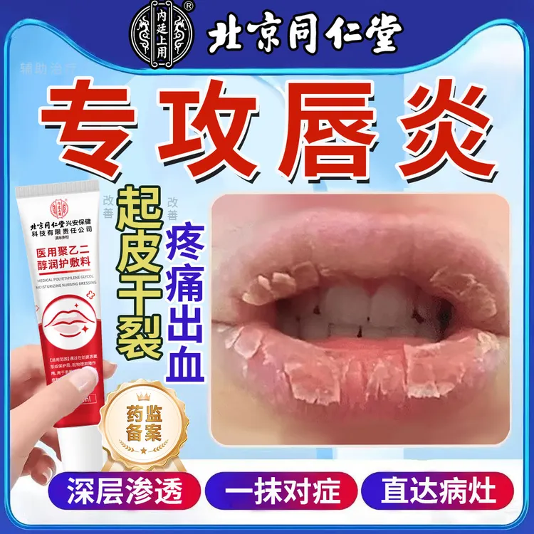 北京同仁堂唇炎专用唇部膏嘴唇干裂疼痛肿胀灼热起皮嘴角裂口干燥流血内廷上用医用聚乙二醇润护敷料