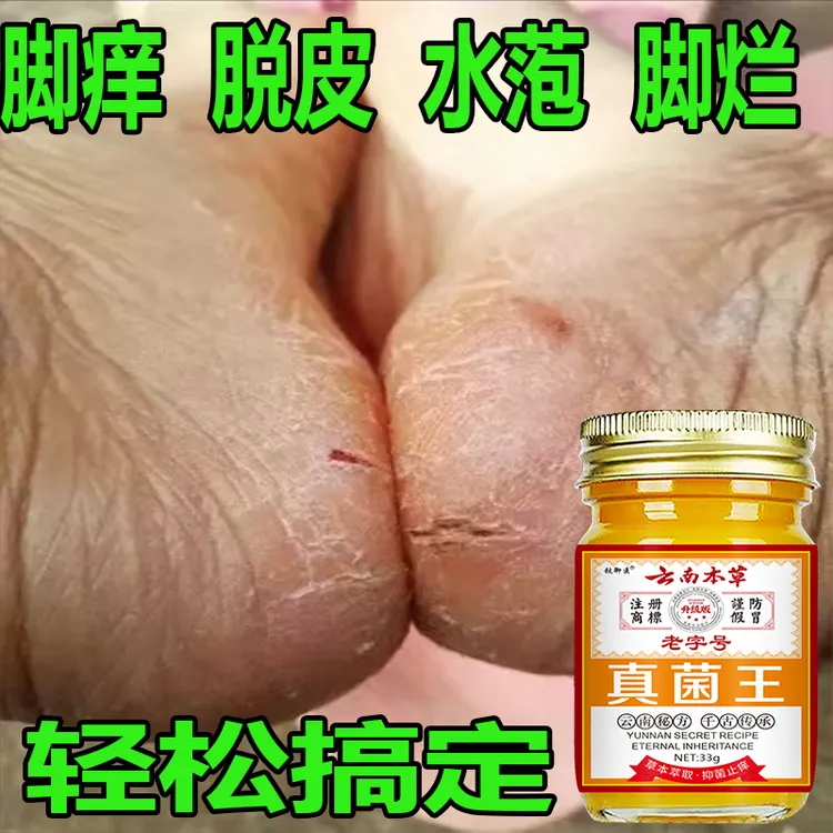 正品真菌王脚痒脚臭脚缝痒脱皮脚底痒脚止痒膏肩颈贴脚部问题适用