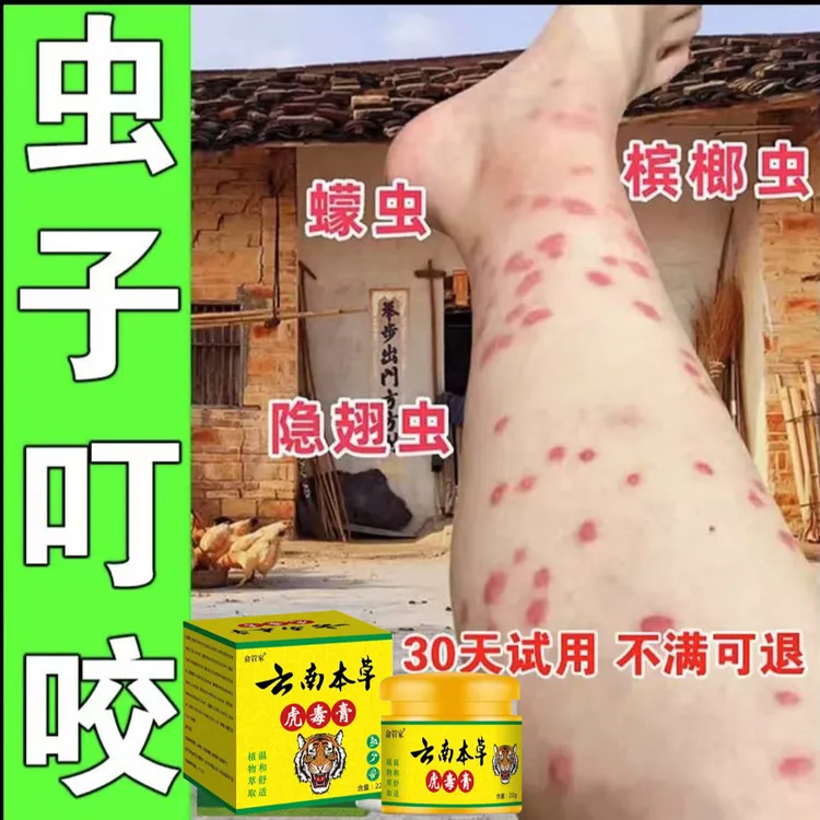 跳蚤咬蚊虫叮咬止痒膏消红肿液蚊子咬儿童成人皮肤草本外用乳膏