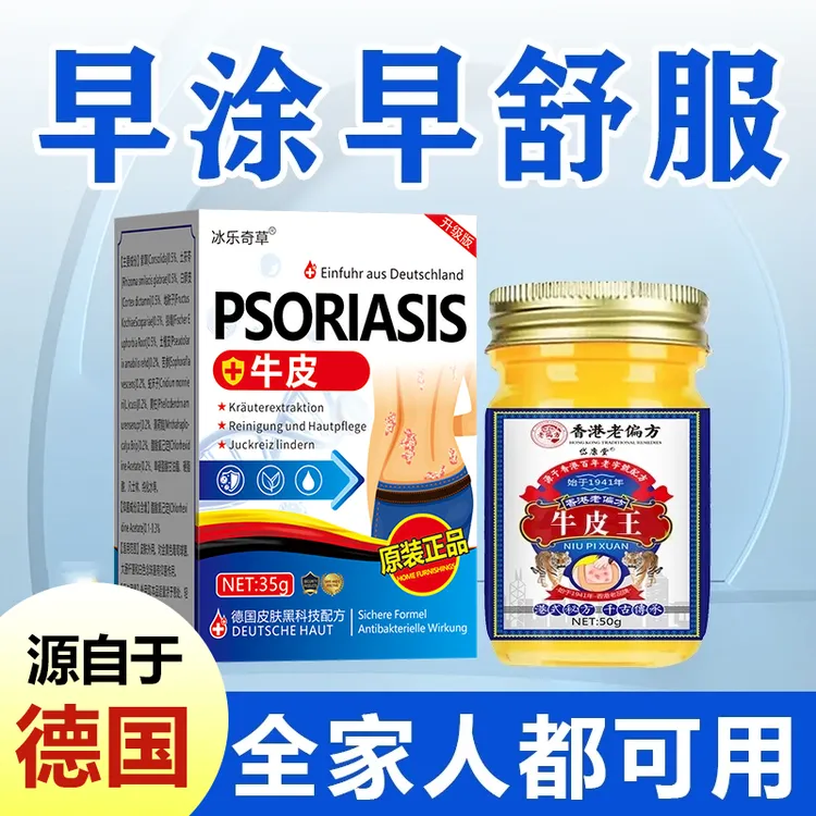 【德国正品】全身牛/皮/银/屑/鲜手足头体股大腿内侧草本止痒乳膏