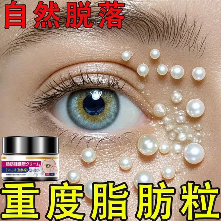 日本眼部脂肪颗粒眼周汗管油脂粒细纹黑眼圈男女通用眼霜草本乳膏