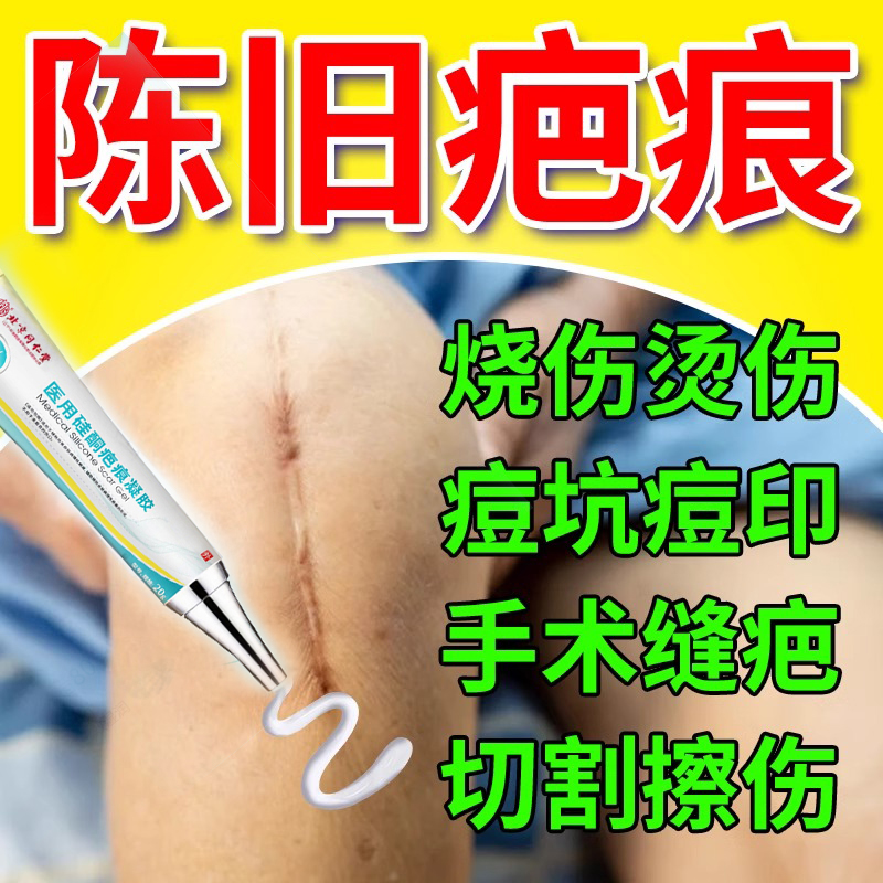 北京同仁堂烧伤烫伤创伤剖腹产手术疤痕膏辅助改善皮肤病理性疤痕预防疤痕形成内廷上用医用硅酮疤痕凝胶20