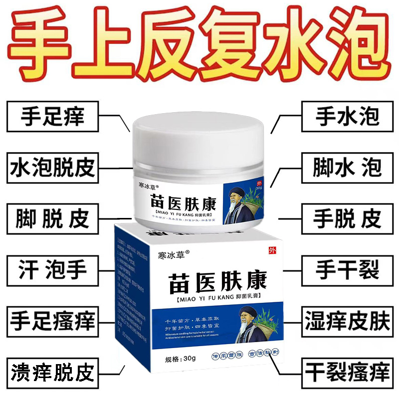 汗泡诊克星手上起小水泡止痒膏脱皮抑菌手指缝痒干裂专用草本乳膏