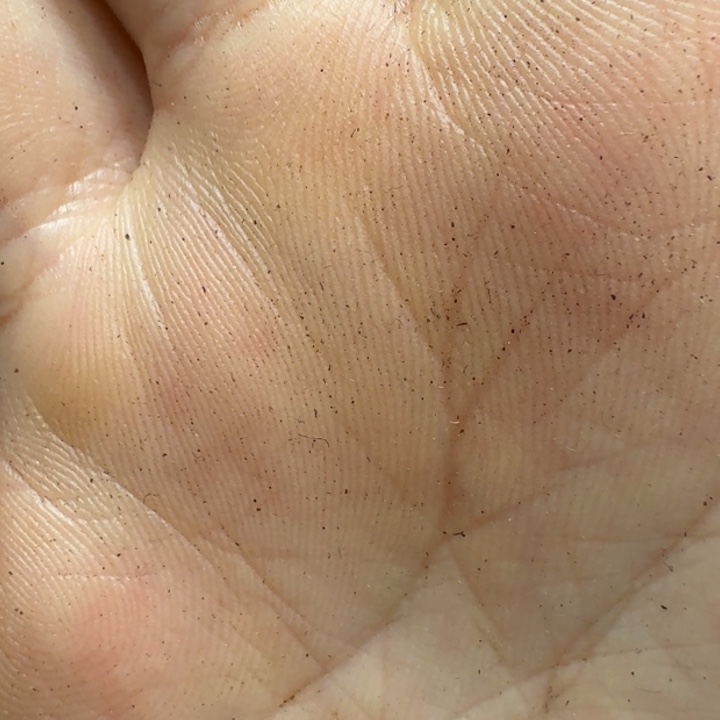 以***眼大果紫檀（缅甸花梨）