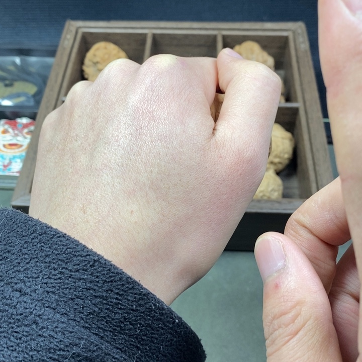 ****6核桃等经济林果地的作用，