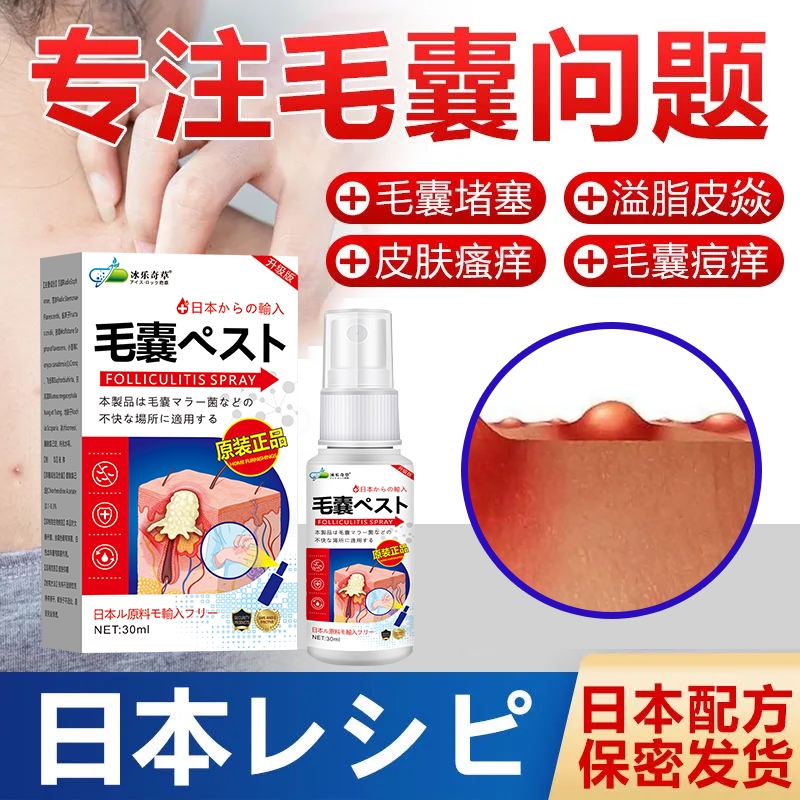 头廯专用喷剂头皮廯囊焱头皮疙瘩痘痘脓包头皮瘙痒头廯专用特效