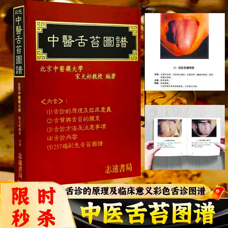中医舌苔图谱 现货速发
