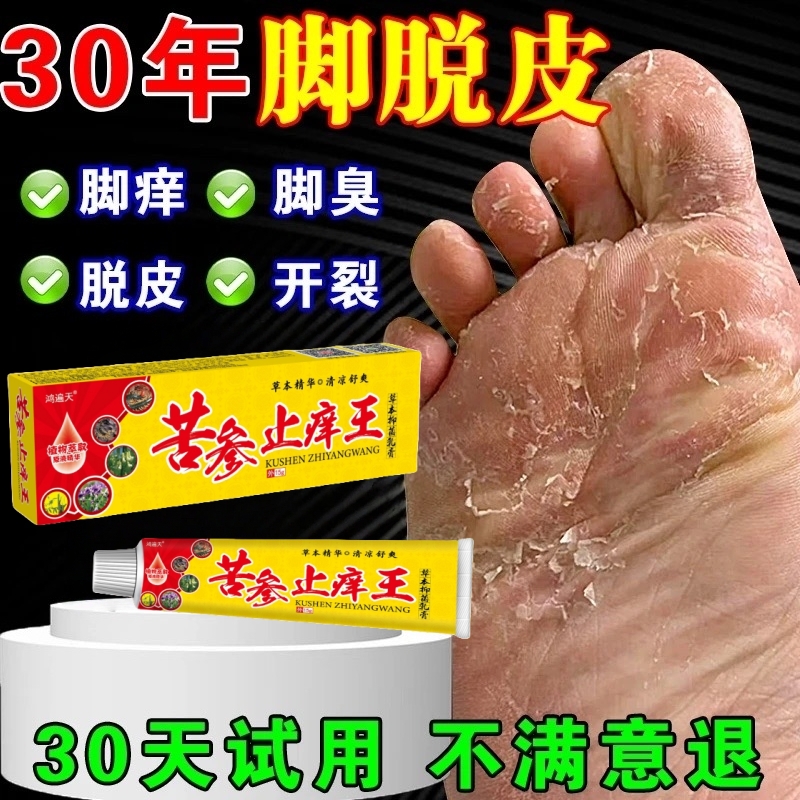 脚趾缝痒专用去脚痒脚臭气止痒神器香港脚脱皮开裂克星抑菌止痒膏