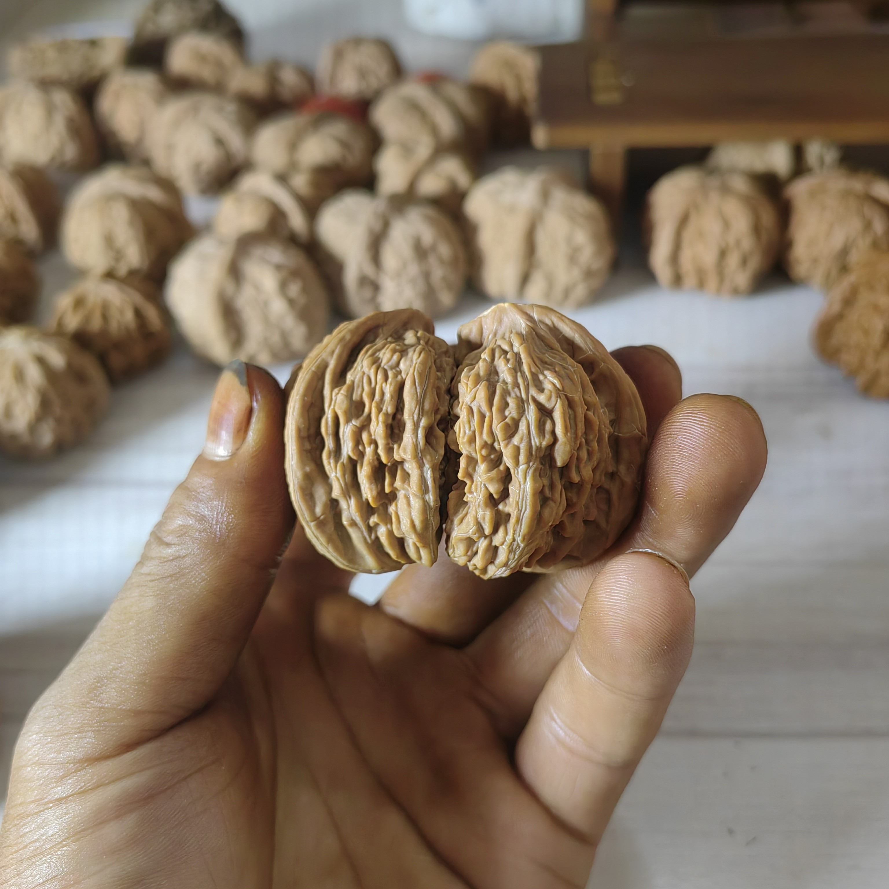 金品南疆半壁骨质增生牛逼