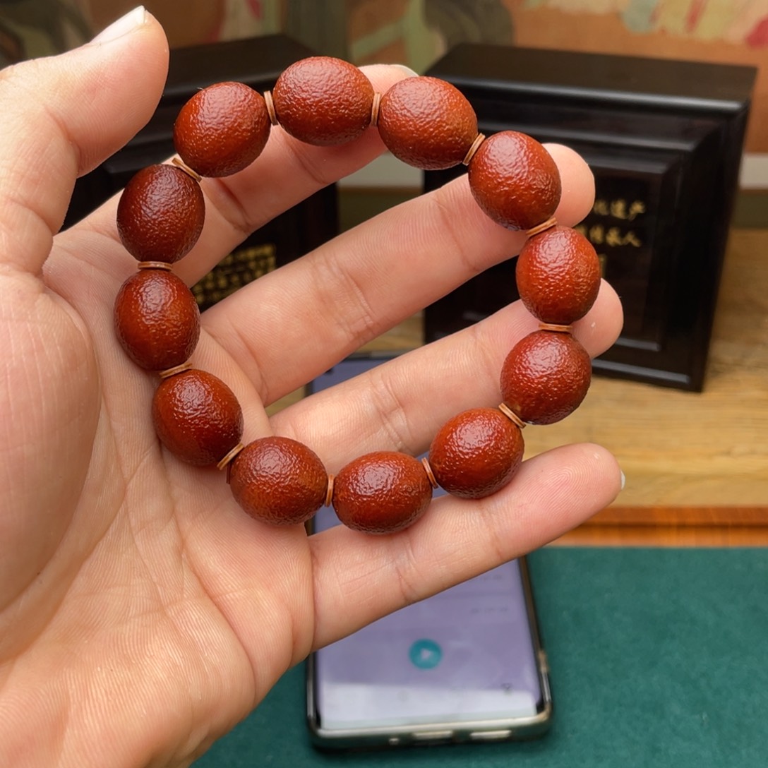 橄榄核手串张*橘皮纹表弟回血