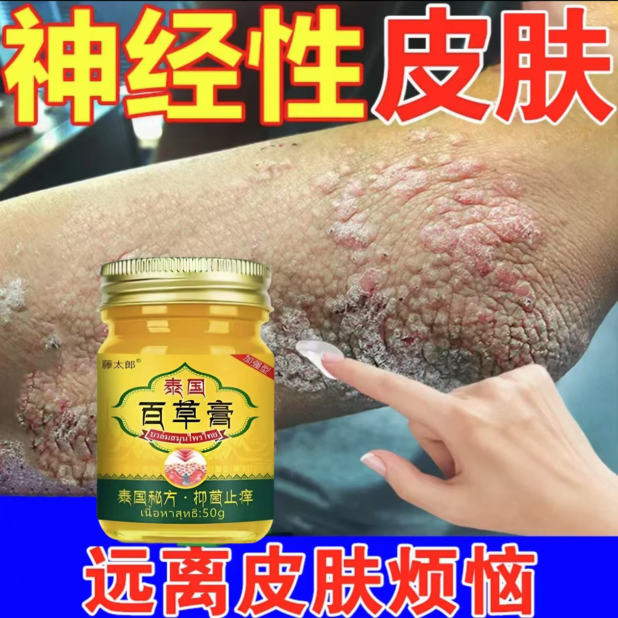 神经性皮肤脂溢性日光性皮肤很痒泰国止痒膏全身可用涂抹抑菌乳膏