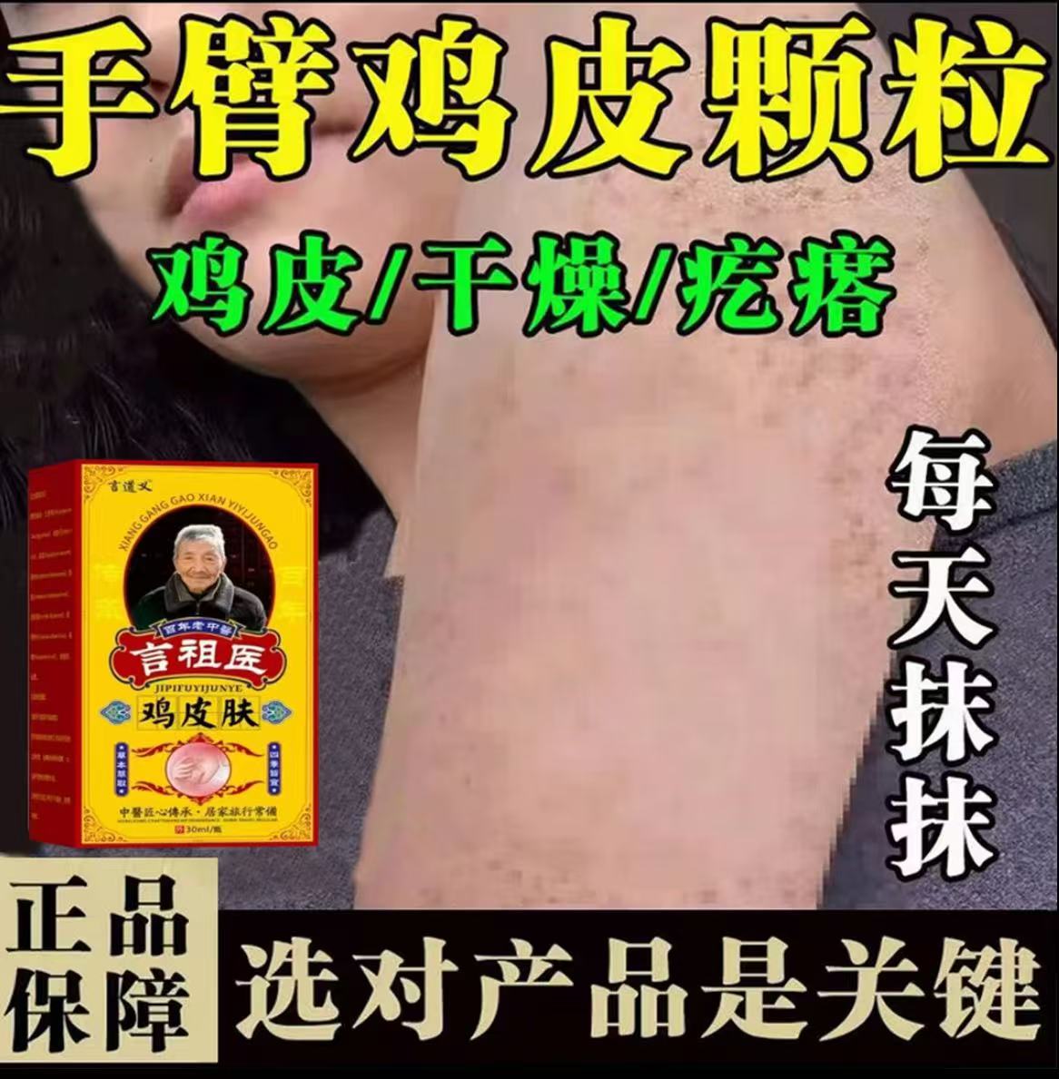 胳膊腿上鸡皮疙瘩毛囊堵黑点痘痘手臂密集小颗粒腿上干燥粗糙乳膏