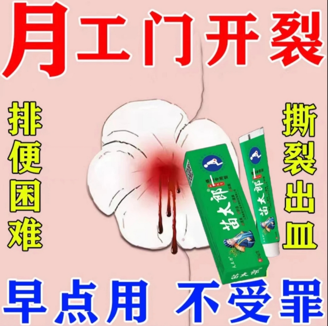 【便血/瘙痒救星】痔创凝胶痔创膏消 内、外、混合、痔消止痛肛周痒