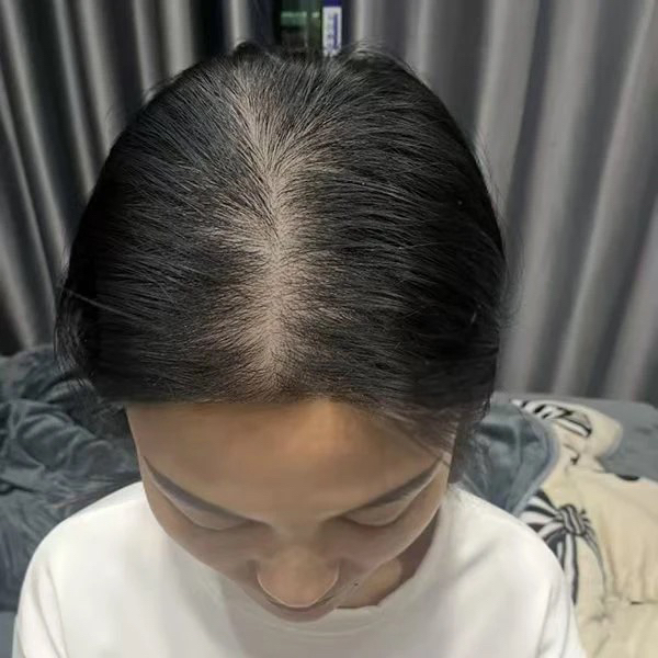 丹丹生完孩子产后照片梳