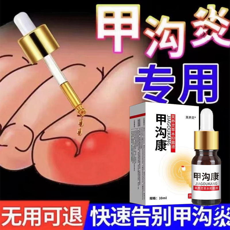 甲沟康指甲长肉里软甲脱甲液脚趾甲化脓嵌甲肉芽脚指头疼甲沟膏