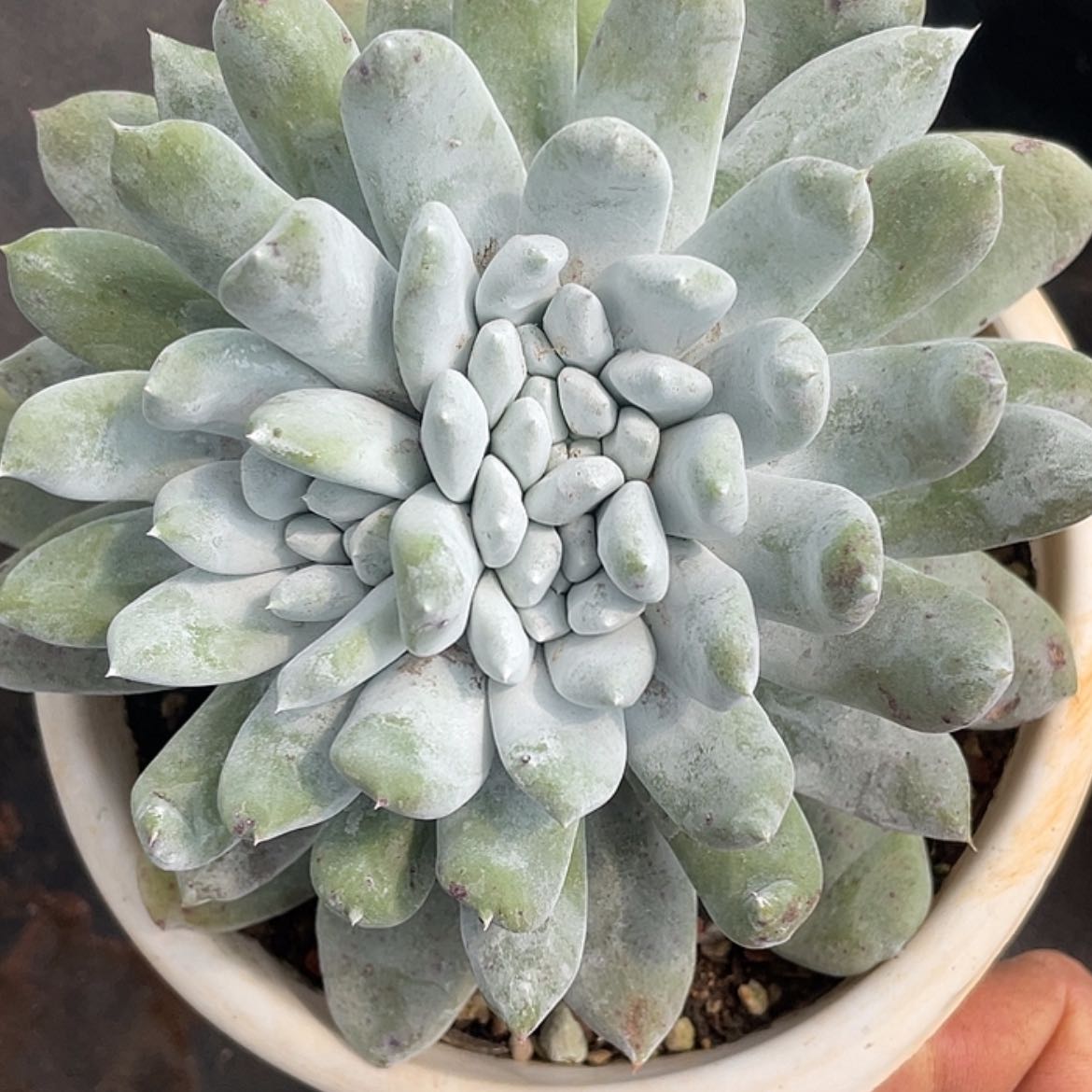 【闪购商品】拇指缀化