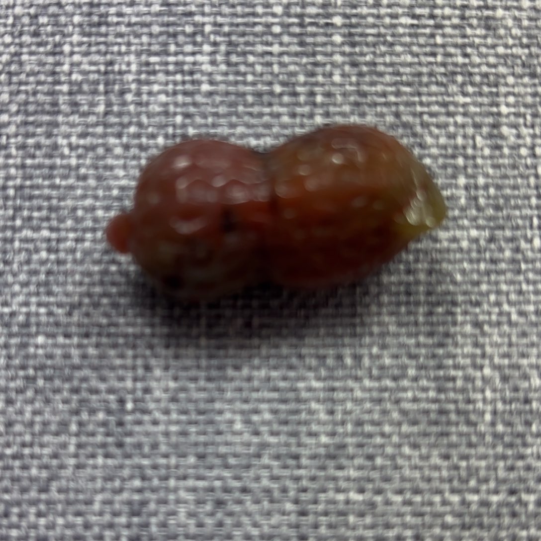 玛瑙/玉髓花生钛钢…*