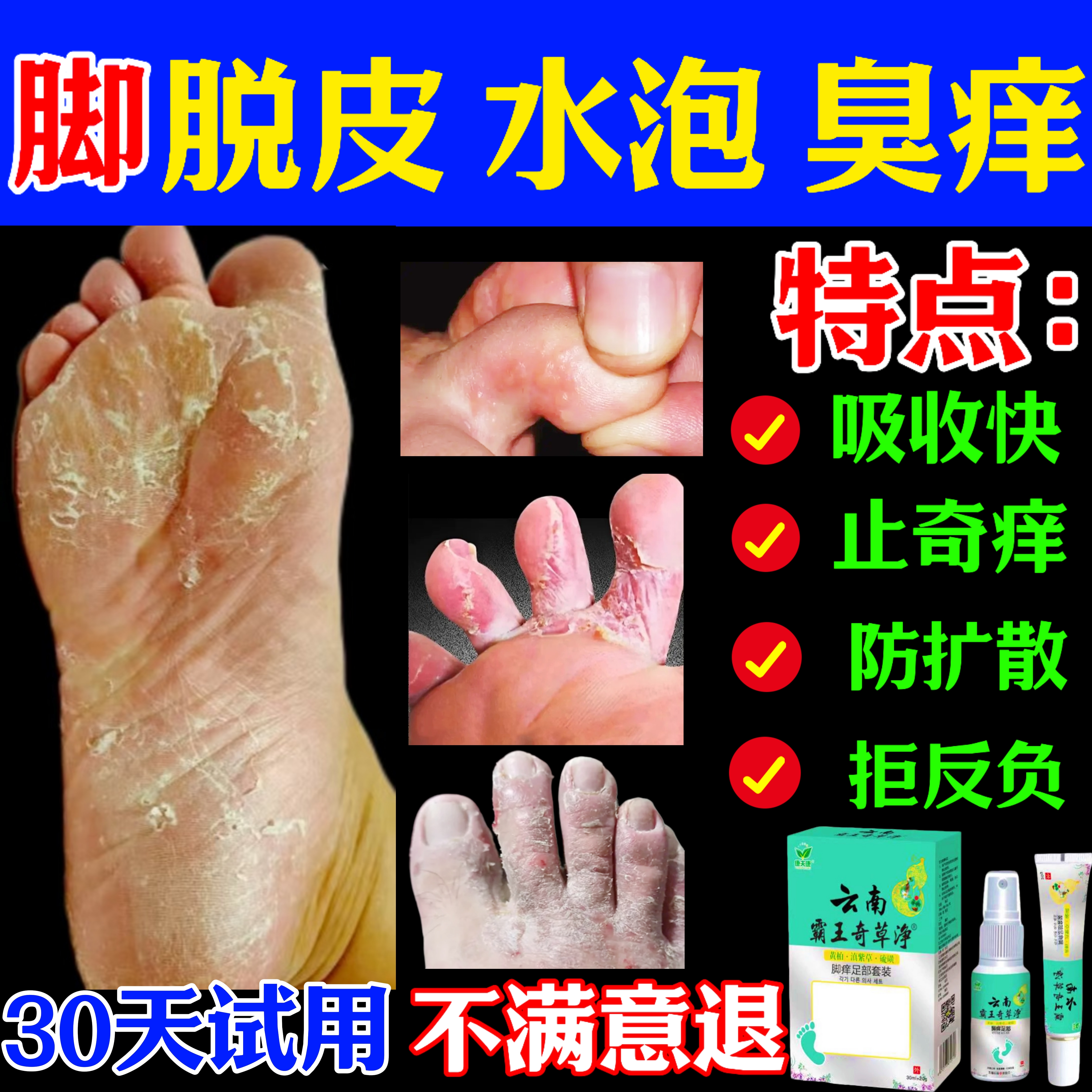 脚痒脚臭止痒膏去脚出汗脱皮起水泡干裂脚趾缝痒喷剂抑菌止痒神器