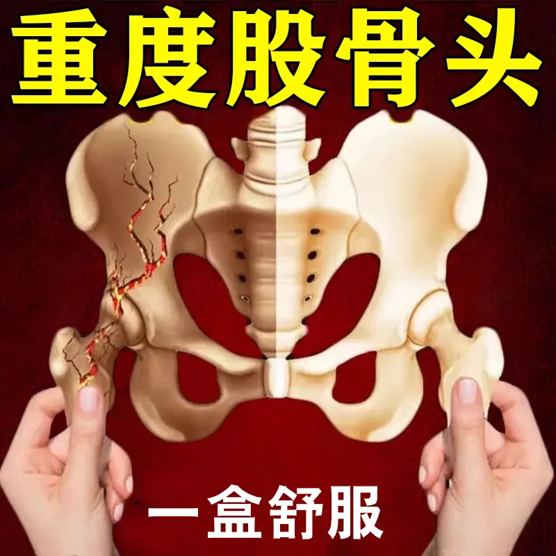 股骨头坏问题专用膏涂抹髋关节活动困难下蹲困难僵硬痛草本外用膏