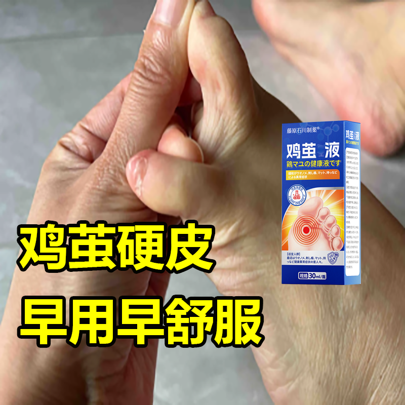 脚钉鸡茧手脚趾鸡厚皮茧去脚上老茧神器底脚垫走路疼下地困难