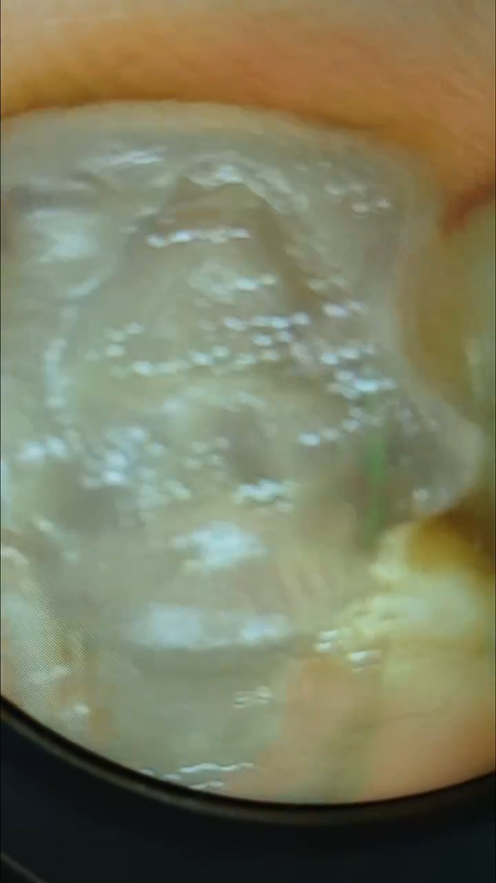 GC-黑黑桃张竖 异色 多样性发其一