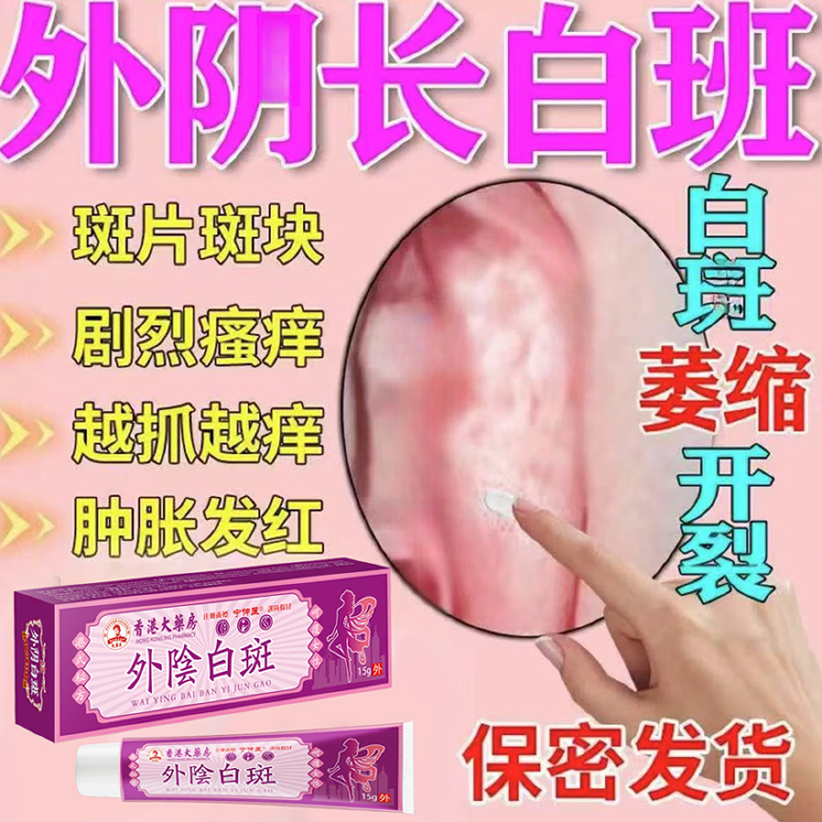 【香港大藥房】外荫白班硬化苔廯营养不良萎缩发白瘙痒止痒直播间