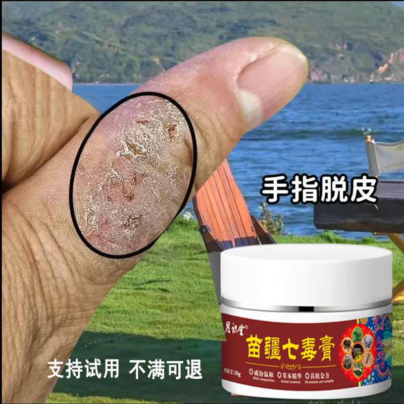 超好用的手足干裂脱皮克星草本抑菌膏四季修护神器抑菌止痒涂抹膏