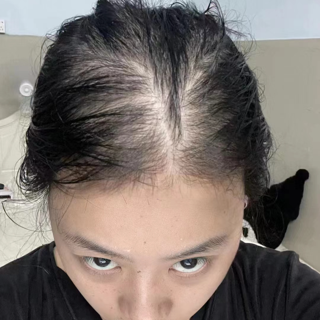 梨子生完孩子产后照片梳