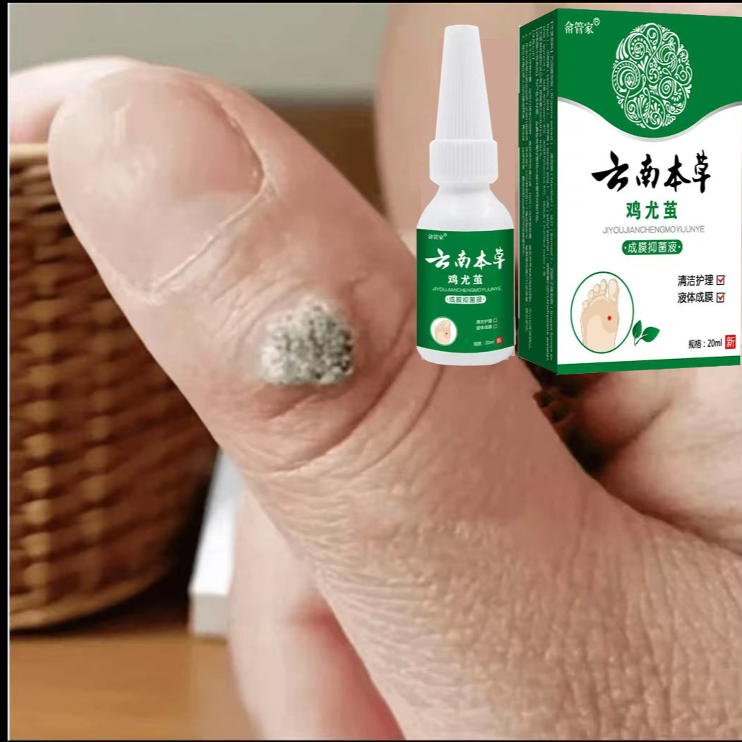 【快速脱落】身上长肉粒脖子长肉鸡茧手全身足腋下忧球专用涂抹